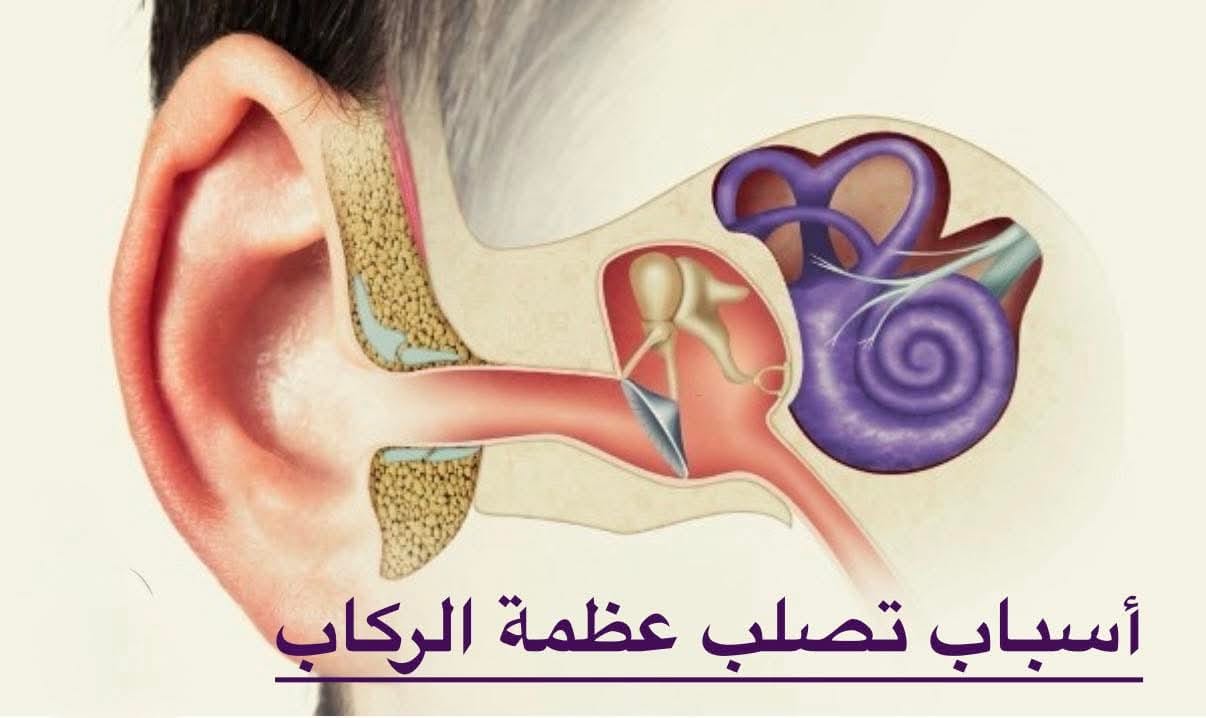 ليه عظمة الركاب بتتيبّس؟ أسباب تيبس عظمة الركاب