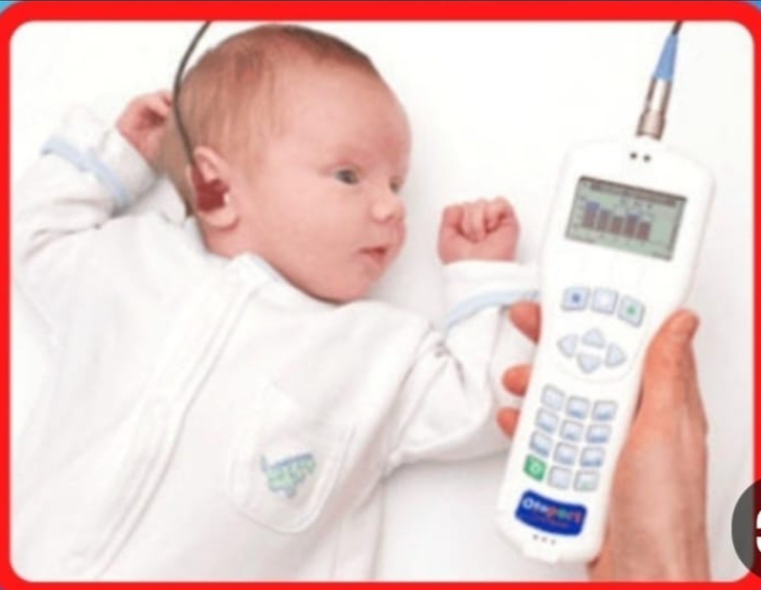 كيف نفسّر نتيجة OAE؟